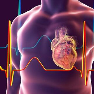 cardiac syndrome with cervical osteonecrosis