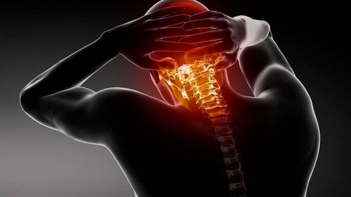 headache with cervical osteonecrosis