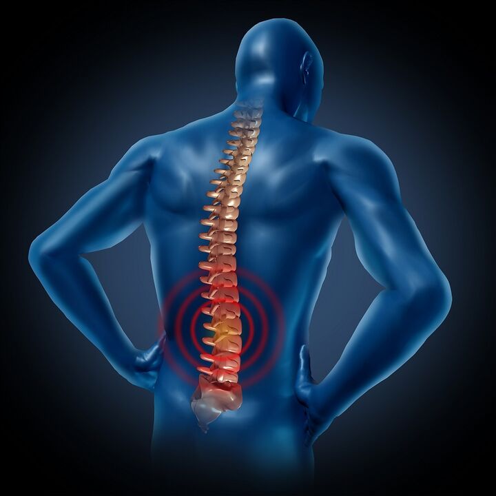 Low back pain