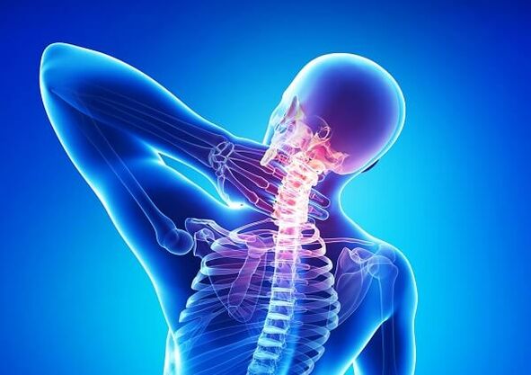 neck pain with osteonecrosis