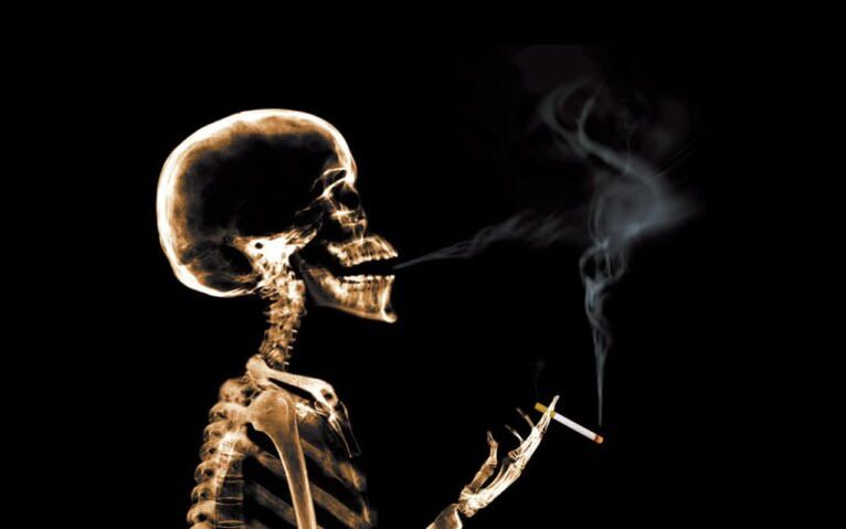 Smoking is the cause of back pain in the shoulder area