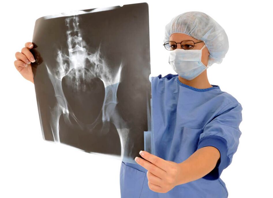 A hip X-ray will help your doctor determine the cause of your pain