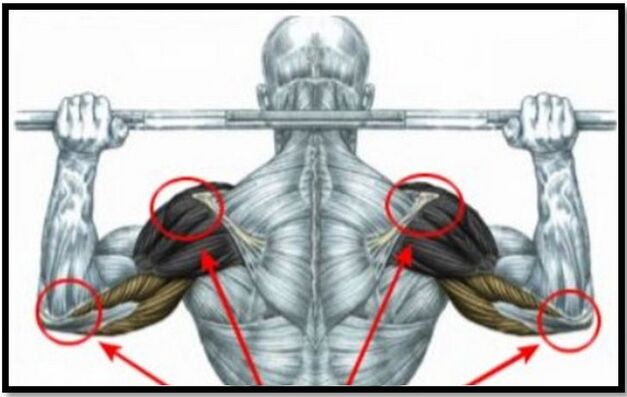 The load on the shoulder and elbow muscles is one of the causes of shoulder osteoarthritis