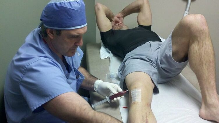 Knee joint treatment