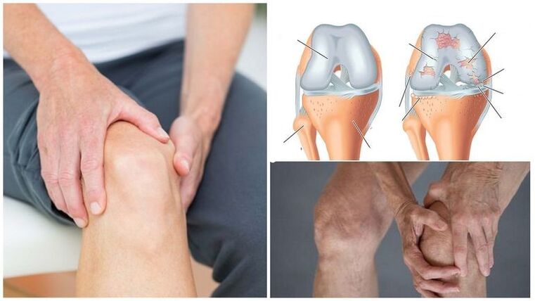 Symptoms of knee pain of knee joints