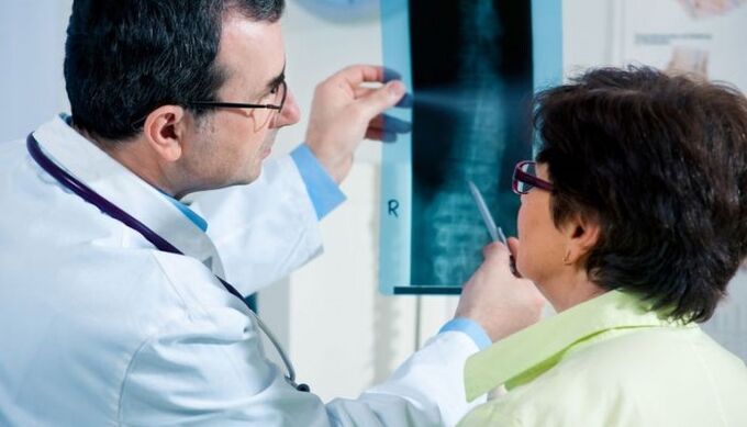 X-ray as a method of diagnosing cervical spondylosis